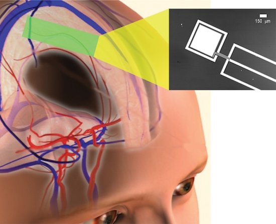 直接從大腦血糖汲取能量的新型燃料電池